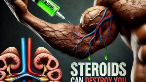 Steroids