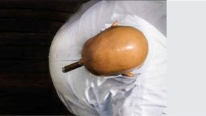 bald