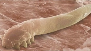 eye-mites