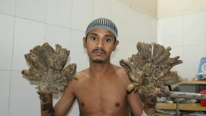 treeman2