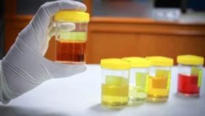 urine2